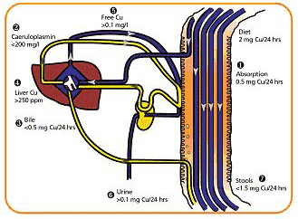 Diagram II: Choroba Wilsona bez leczenia