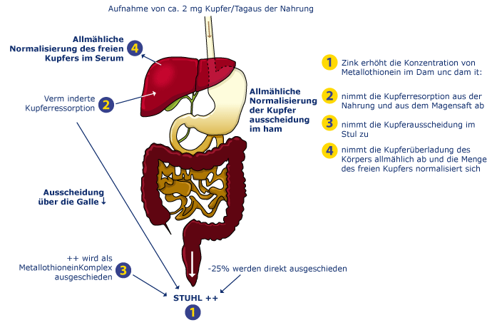 Diagram III: Wilson's disease patients on zinc therapy: enhanced faecal excretion of copper