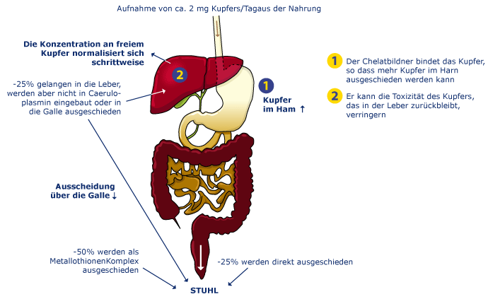 Diagram IV: Wilson's disease patients on chelator therapy: enhanced urinary excretion of copper